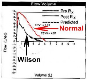 3-rbw-asthma-flowvolume-graph-20090923-rednormal-blackwilson